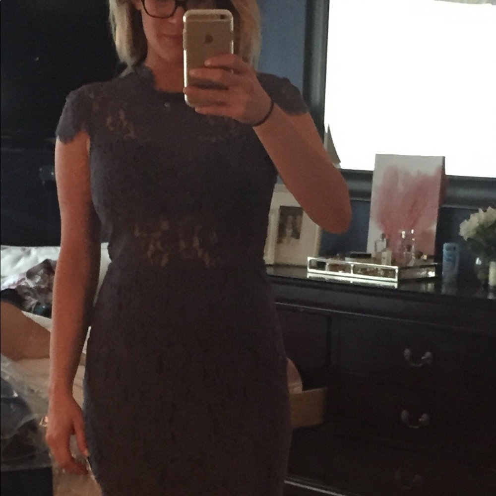 Dolce vita lace dress